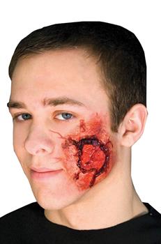 Open Wound Kit
