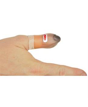 Bruised Thumb