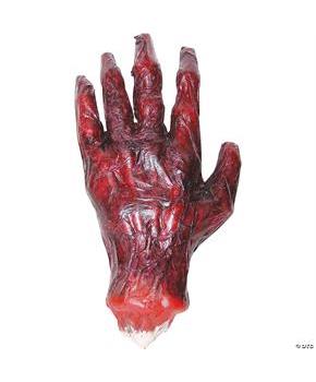 Burnt Hand
